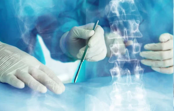 Spine Surgery