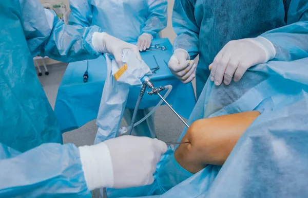 Arthroscopy